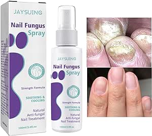 Nail Fungus Spray - Kbr Express