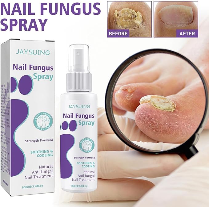 Nail Fungus Spray - Kbr Express